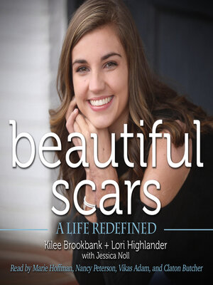 cover image of Beautiful Scars